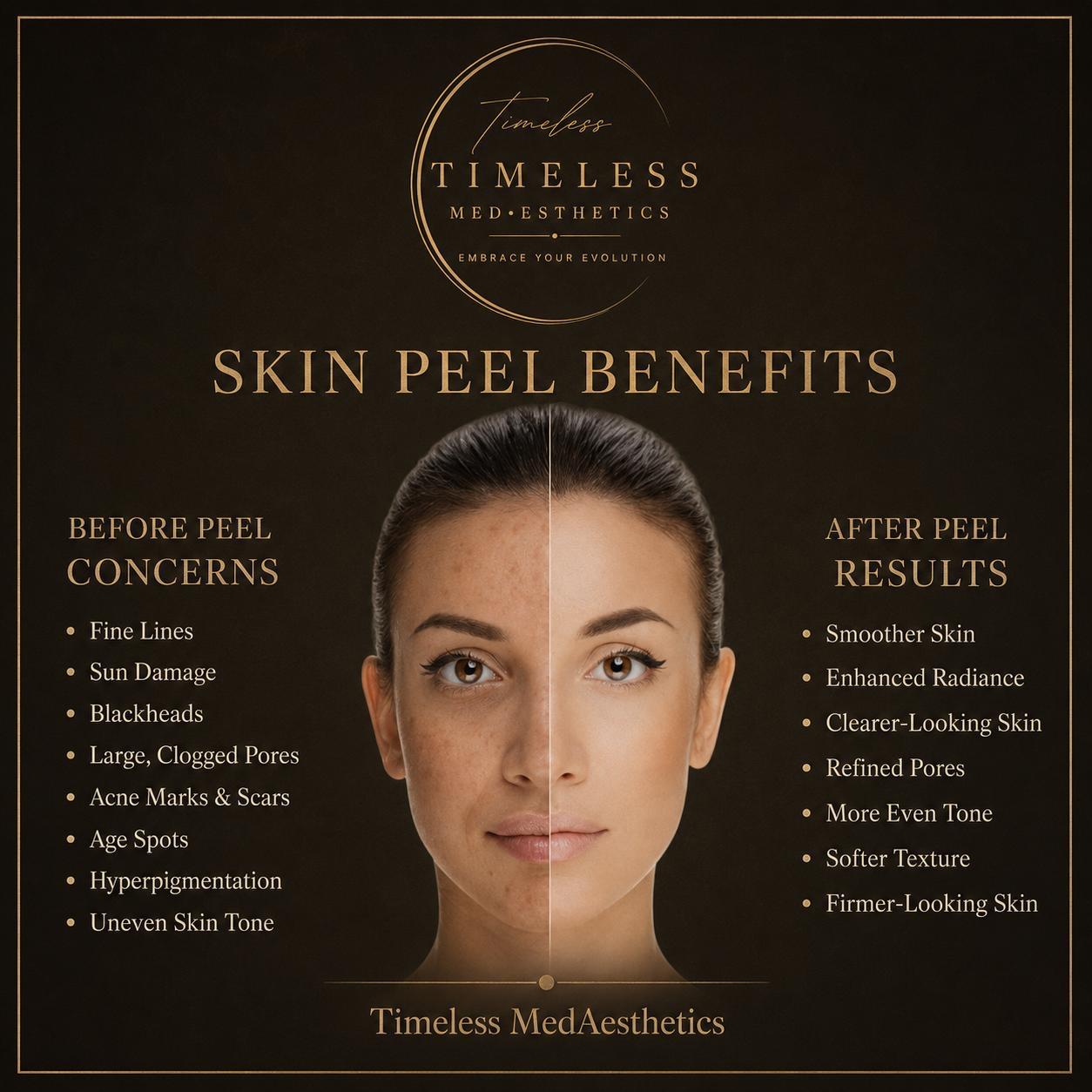 Glycolic peel and skin renewal